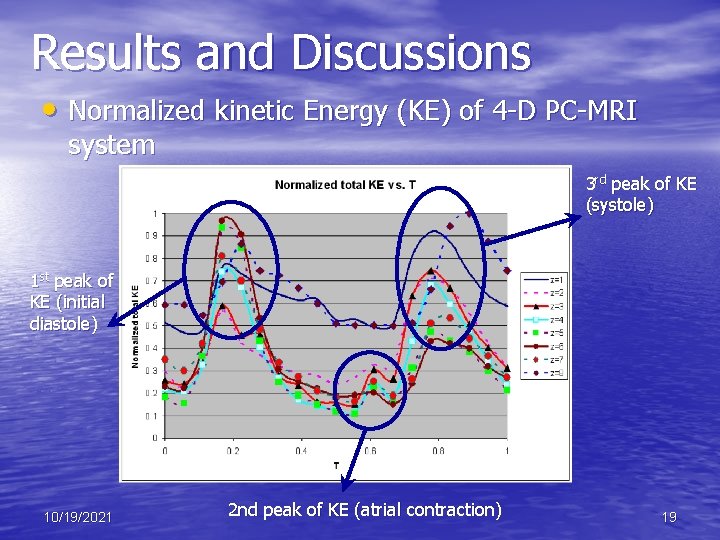 Results and Discussions • Normalized kinetic Energy (KE) of 4 -D PC-MRI system 3