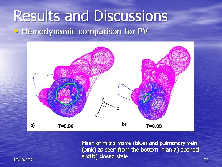 Results and Discussions • Hemodynamic comparison for PV 10/19/2021 Mesh of mitral valve (blue)