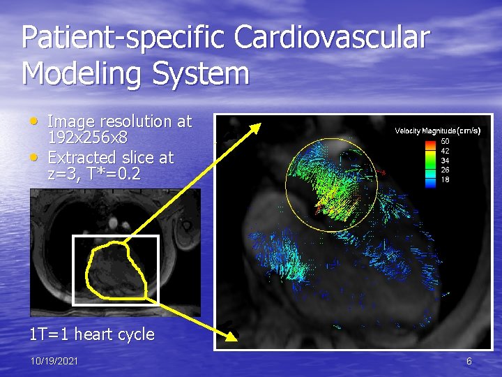 Patient-specific Cardiovascular Modeling System • Image resolution at • 192 x 256 x 8