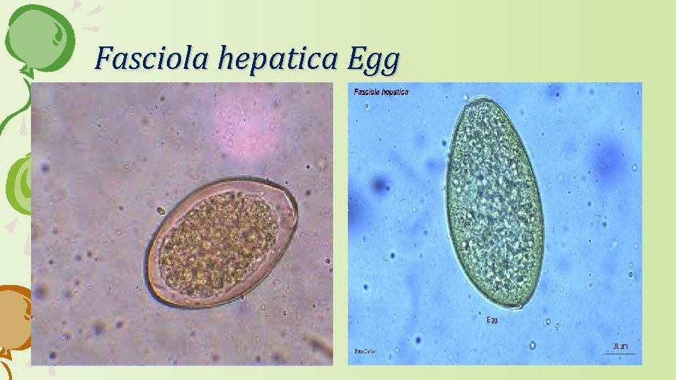 Fasciola hepatica Egg 