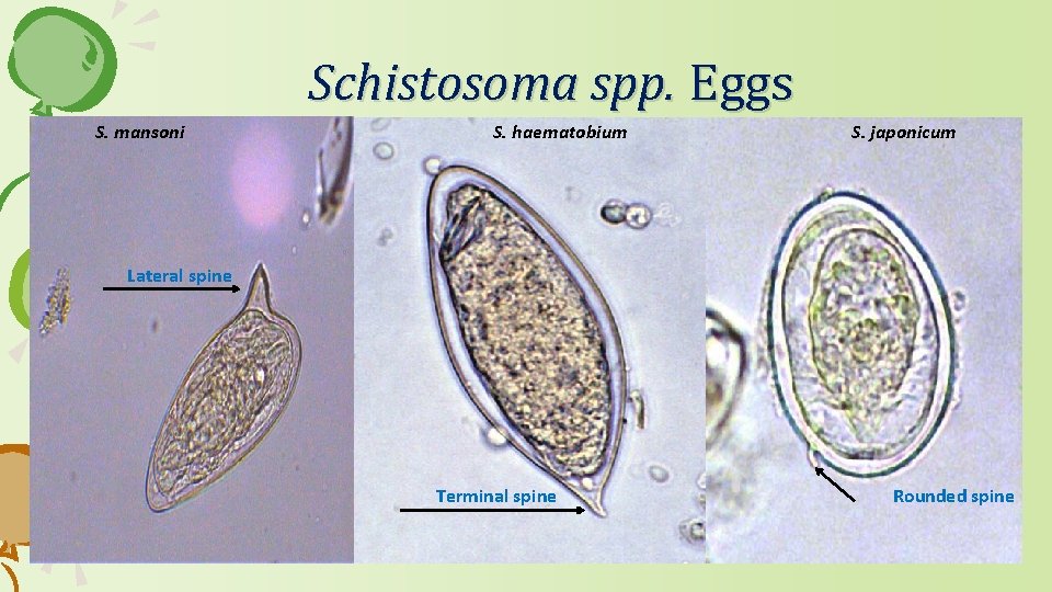 Schistosoma spp. Eggs S. mansoni S. haematobium S. japonicum Lateral spine Terminal spine Rounded