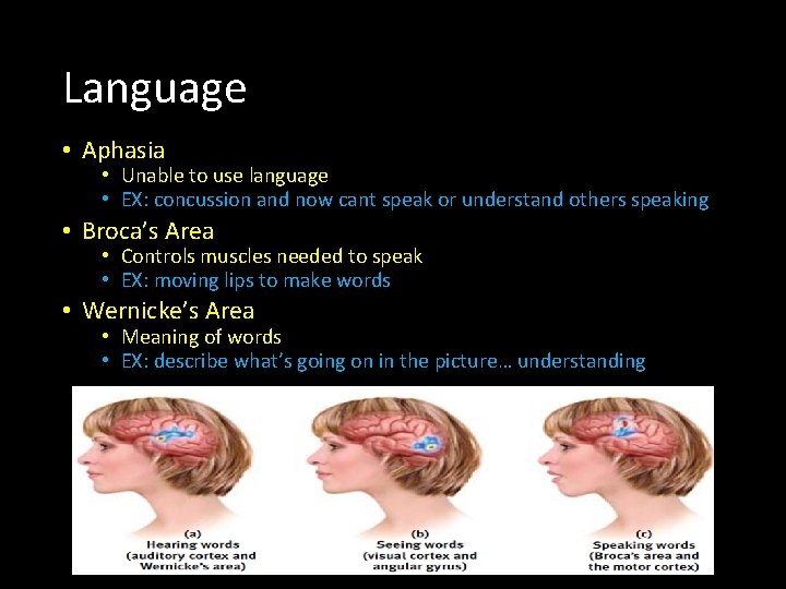Language • Aphasia • Unable to use language • EX: concussion and now cant