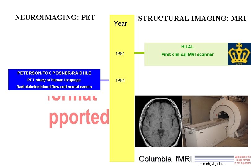 NEUROIMAGING: PET Year STRUCTURAL IMAGING: MRI HILAL 1981 First clinical MRI scanner PETERSON/FOX POSNER/RAICHLE