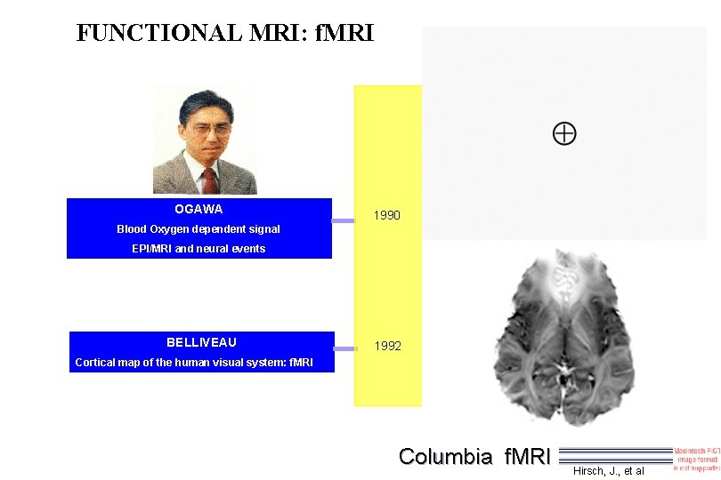 FUNCTIONAL MRI: f. MRI OGAWA 1990 Blood Oxygen dependent signal EPI/MRI and neural events