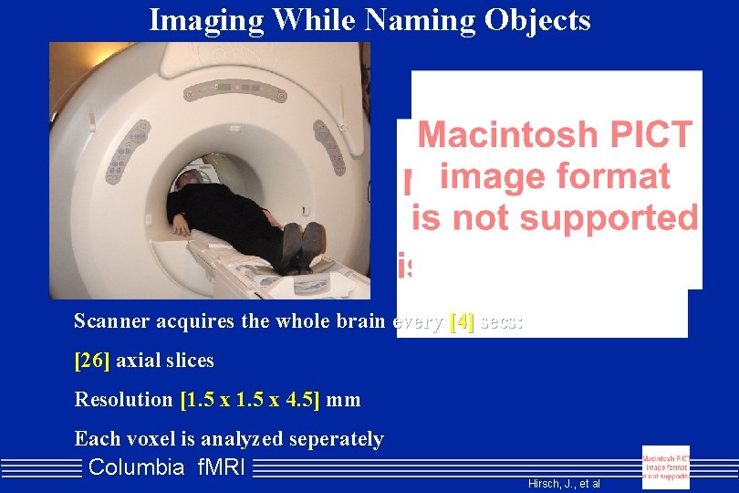 Imaging While Naming Objects Scanner acquires the whole brain every [4] secs: [26] axial