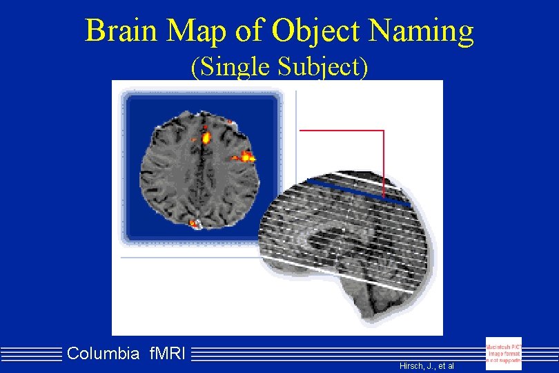 Brain Map of Object Naming (Single Subject) Columbia f. MRI Hirsch, J. , et