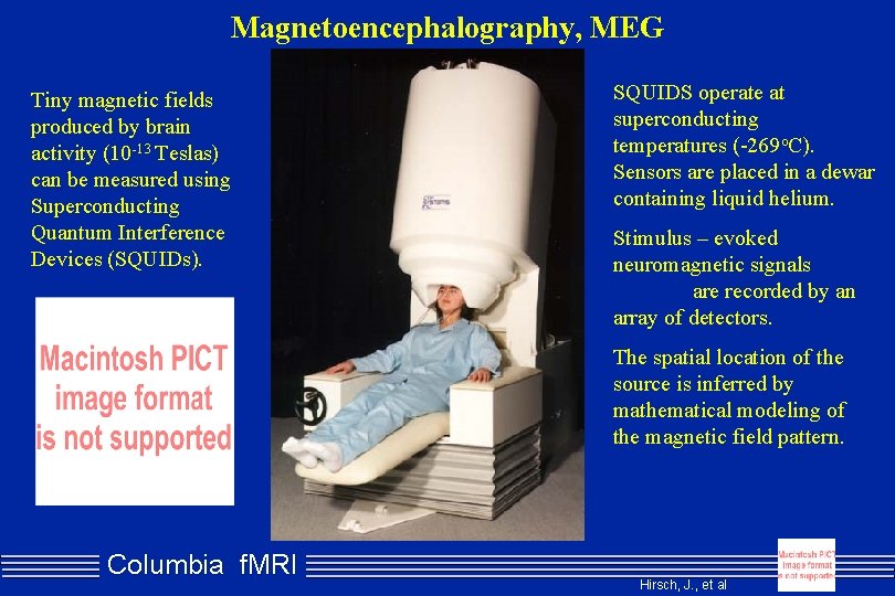 Magnetoencephalography, MEG Tiny magnetic fields produced by brain activity (10 -13 Teslas) can be