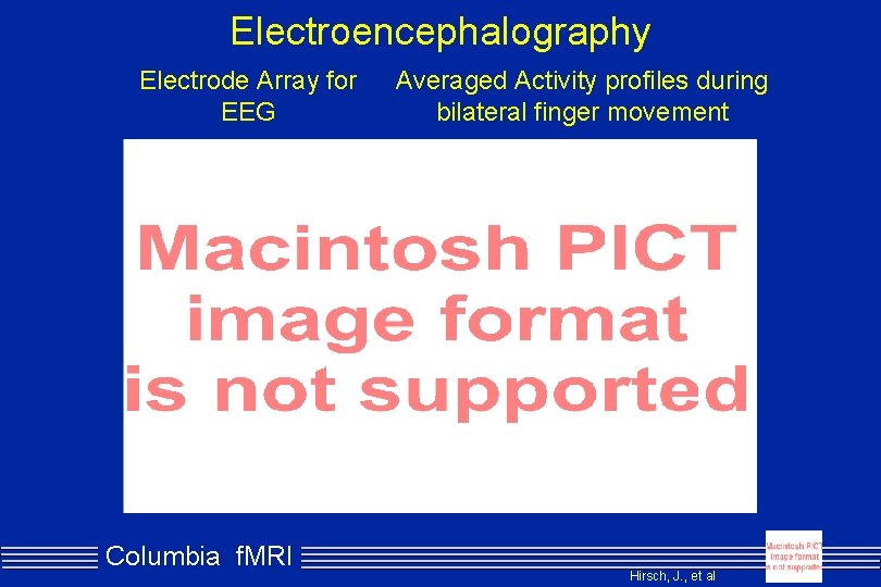 Electroencephalography Electrode Array for EEG Columbia f. MRI Averaged Activity profiles during bilateral finger