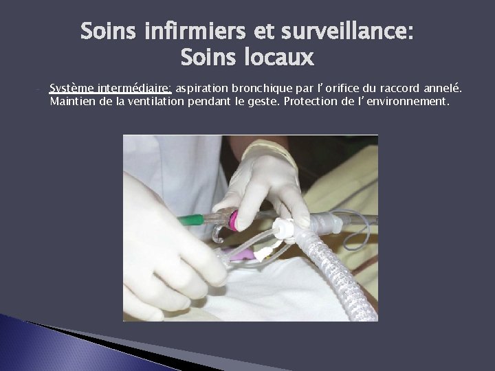 Soins infirmiers et surveillance: Soins locaux - Système intermédiaire: aspiration bronchique par l’orifice du