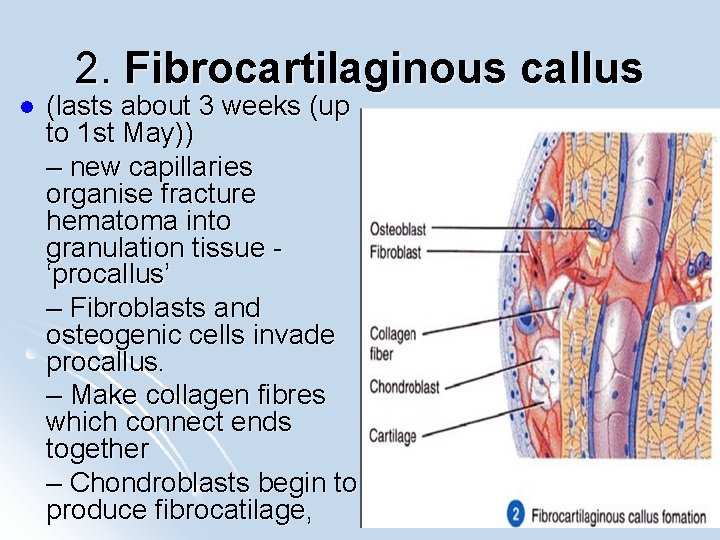 2. Fibrocartilaginous callus l (lasts about 3 weeks (up to 1 st May)) –