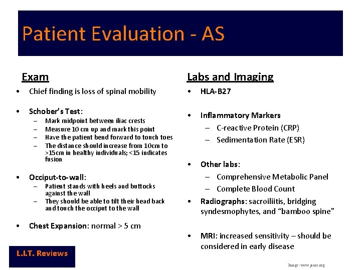 Patient Evaluation - AS Exam Labs and Imaging • Chief finding is loss of