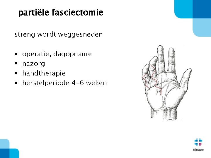 partiële fasciectomie streng wordt weggesneden § § operatie, dagopname nazorg handtherapie herstelperiode 4 -6