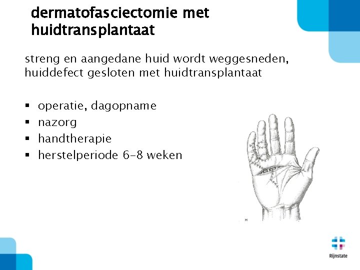 dermatofasciectomie met huidtransplantaat streng en aangedane huid wordt weggesneden, huiddefect gesloten met huidtransplantaat §