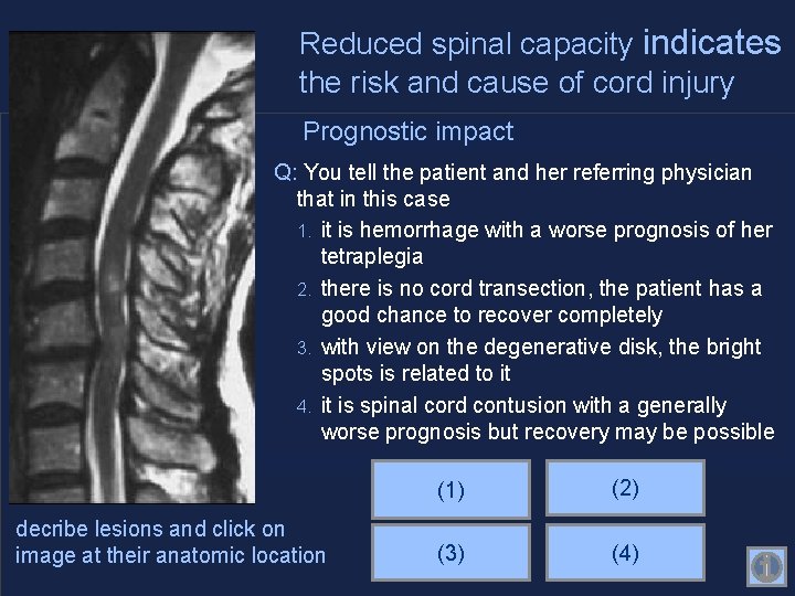 Reduced spinal capacity indicates the risk and cause of cord injury Prognostic impact Q: