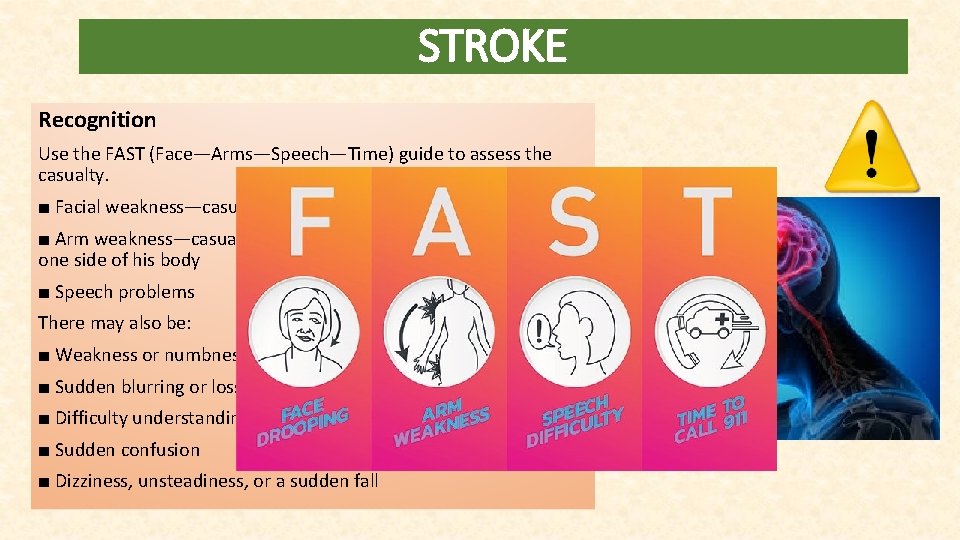 STROKE Recognition Use the FAST (Face—Arms—Speech—Time) guide to assess the casualty. ■ Facial weakness—casualty