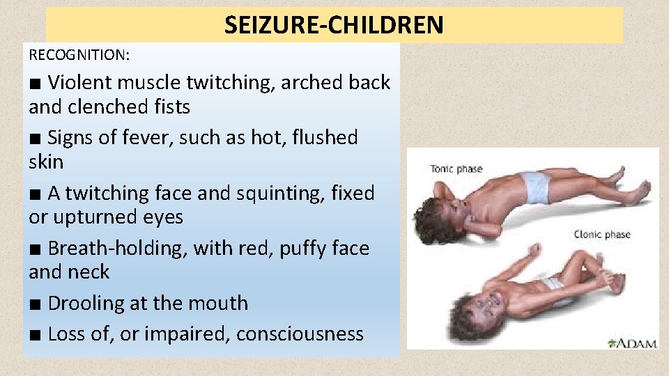 SEIZURE-CHILDREN RECOGNITION: ■ Violent muscle twitching, arched back and clenched fists ■ Signs of