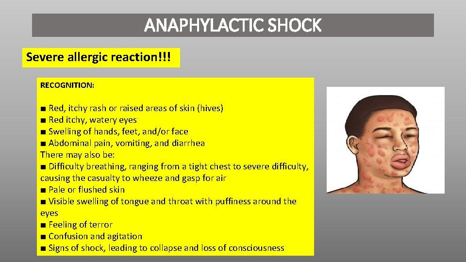 ANAPHYLACTIC SHOCK Severe allergic reaction!!! RECOGNITION: ■ Red, itchy rash or raised areas of