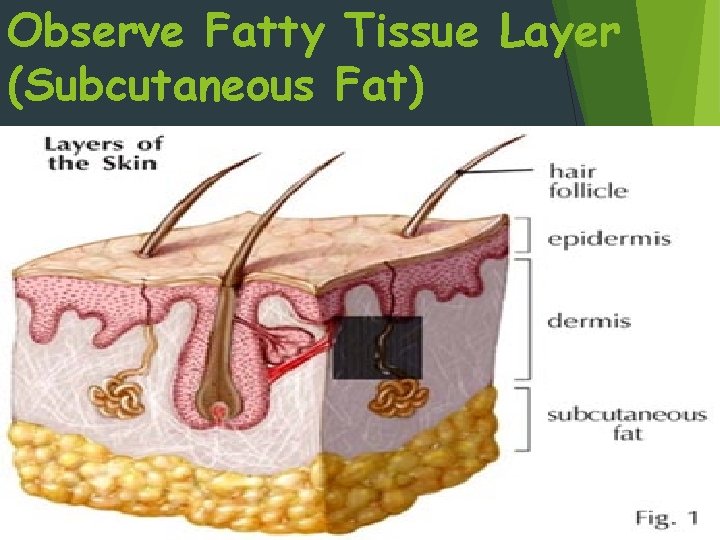 Observe Fatty Tissue Layer (Subcutaneous Fat) 