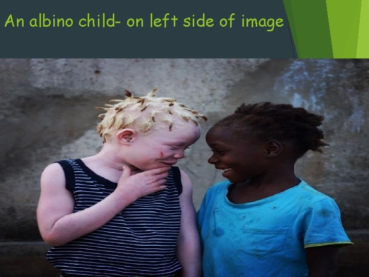 An albino child- on left side of image 