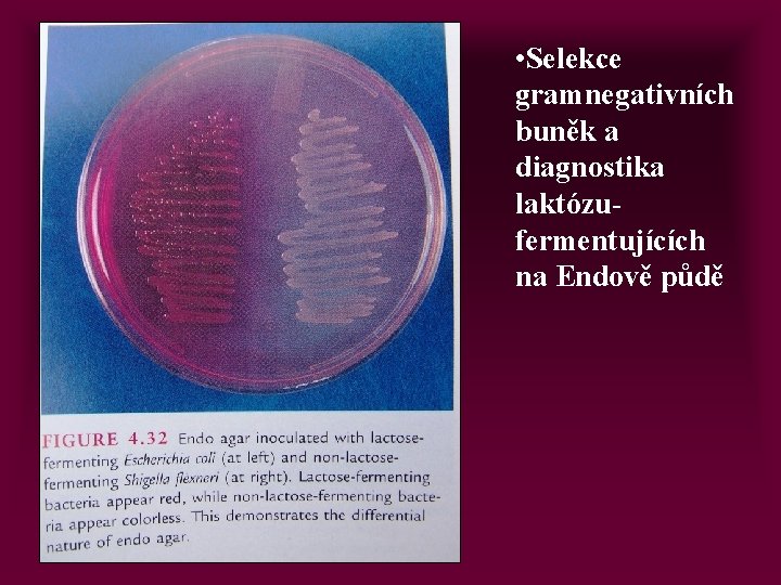  • Selekce gramnegativních buněk a diagnostika laktózufermentujících na Endově půdě 