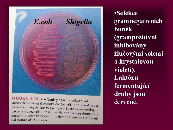 E. coli Shigella • Selekce gramnegativních buněk (grampozitivní inhibovány žlučovými solemi a krystalovou violetí).