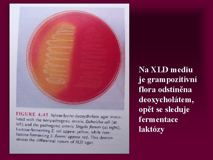 Na XLD mediu je grampozitivní flora odstíněna deoxycholátem, opět se sleduje fermentace laktózy 