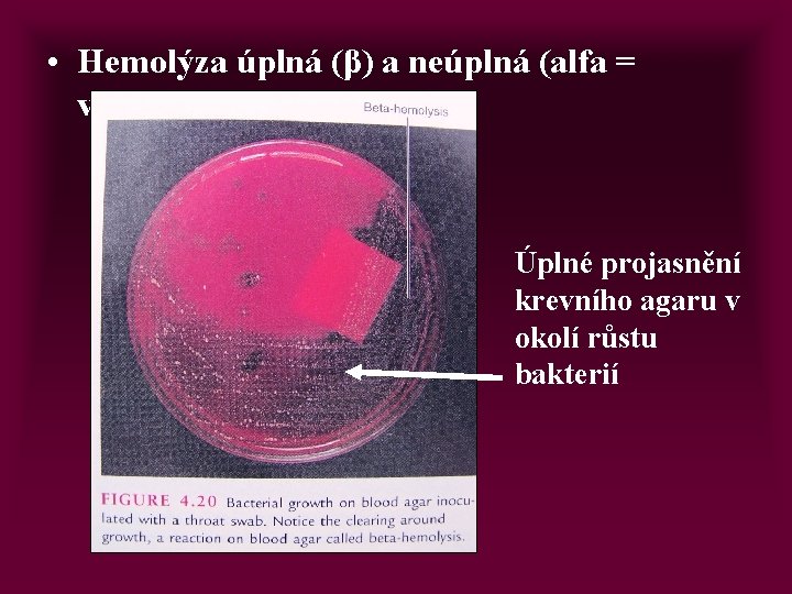  • Hemolýza úplná (β) a neúplná (alfa = viridace) Úplné projasnění krevního agaru