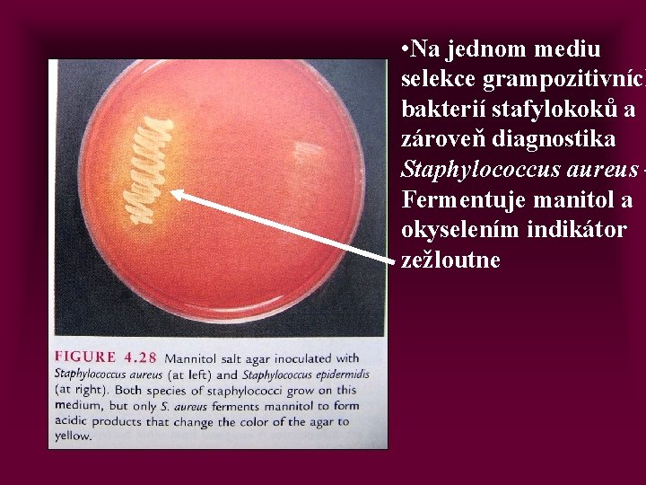  • Na jednom mediu selekce grampozitivních bakterií stafylokoků a zároveň diagnostika Staphylococcus aureus