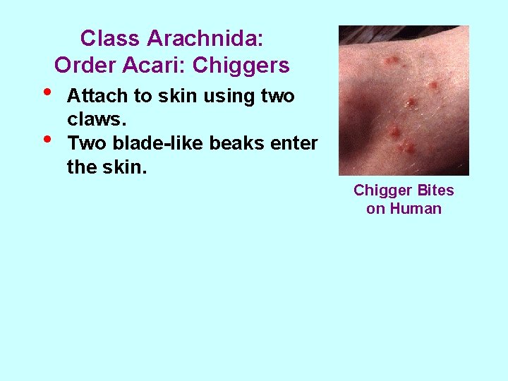  • • Class Arachnida: Order Acari: Chiggers Attach to skin using two claws.