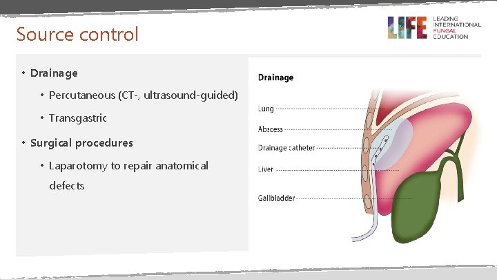 Source control • Drainage • Percutaneous (CT-, ultrasound-guided) • Transgastric • Surgical procedures •