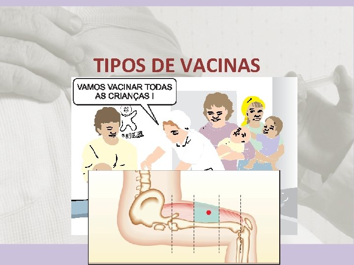 TIPOS DE VACINAS 