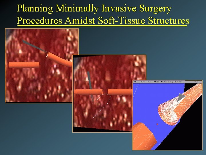 Planning Minimally Invasive Surgery Procedures Amidst Soft-Tissue Structures 