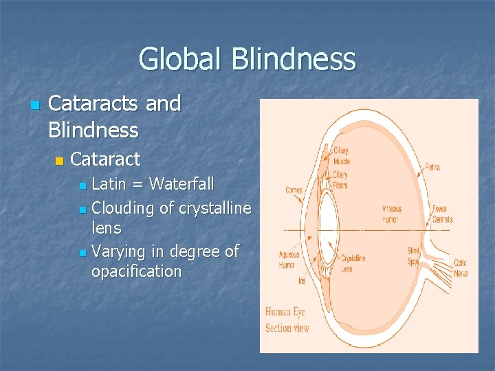 Global Blindness n Cataracts and Blindness n Cataract Latin = Waterfall n Clouding of