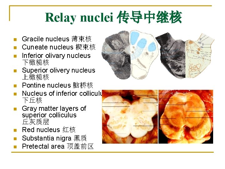 Relay nuclei 传导中继核 n n n n n Gracile nucleus 薄束核 Cuneate nucleus 楔束核