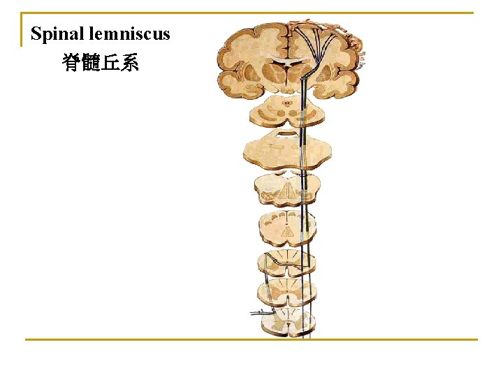 Spinal lemniscus 脊髓丘系 