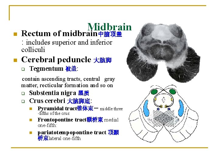 n Midbrain Rectum of midbrain中脑顶盖 : includes superior and inferior colliculi n Cerebral peduncle