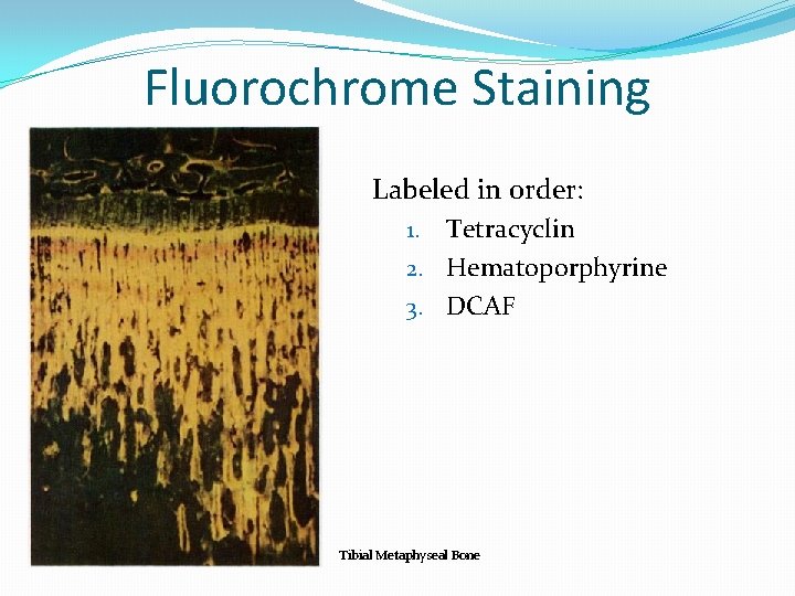 Fluorochrome Staining Labeled in order: Tetracyclin 2. Hematoporphyrine 3. DCAF 1. Tibial Metaphyseal Bone