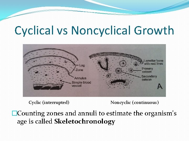 Cyclical vs Noncyclical Growth Cyclic (interrupted) Noncyclic (continuous) �Counting zones and annuli to estimate