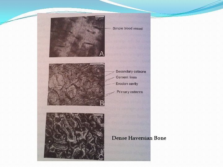 Dense Haversian Bone 