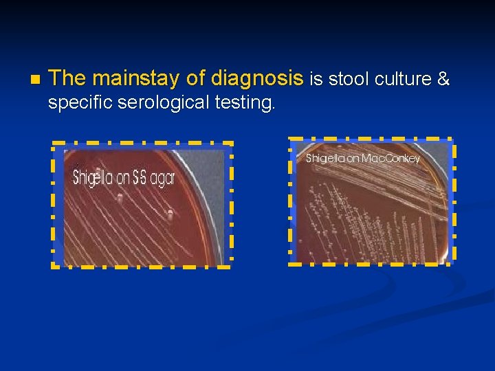 n The mainstay of diagnosis is stool culture & specific serological testing. 