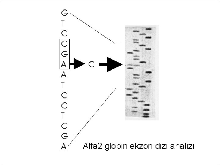 Alfa 2 globin ekzon dizi analizi 