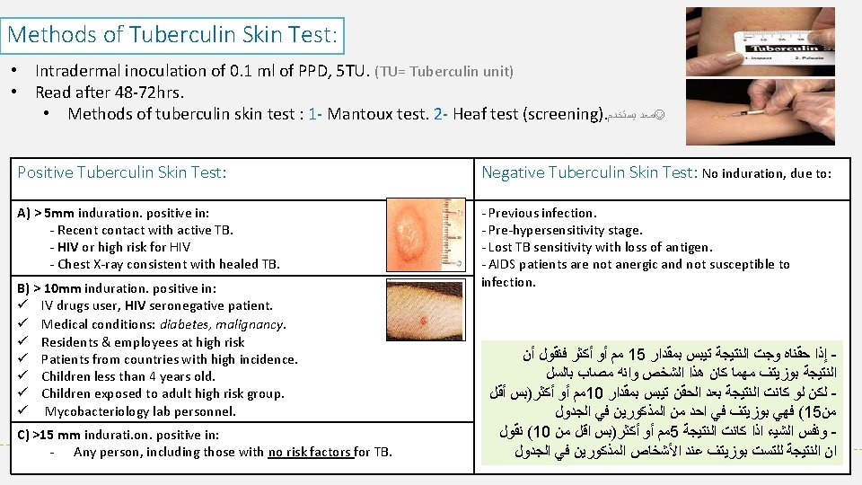 Methods of Tuberculin Skin Test: • Intradermal inoculation of 0. 1 ml of PPD,