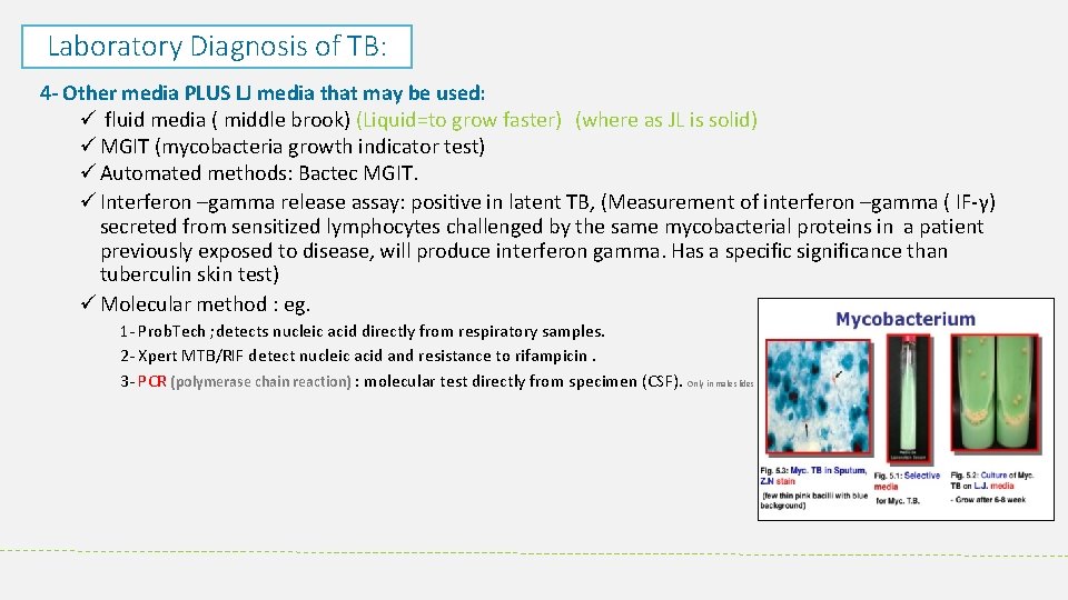 Laboratory Diagnosis of TB: 4 Other media PLUS LJ media that may be used: