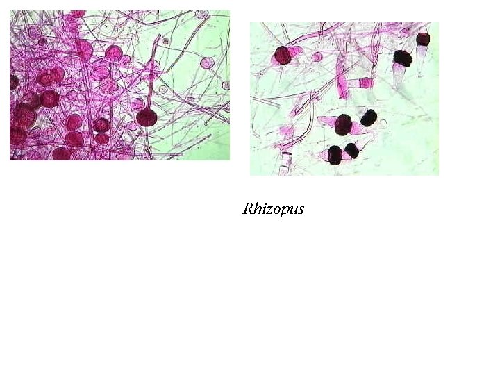 Rhizopus 