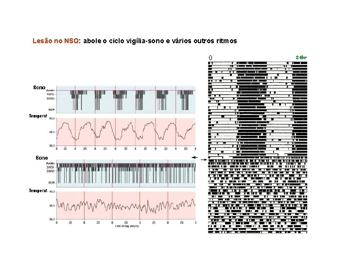 Lesão no NSQ: abole o ciclo vigília-sono e vários outros ritmos 