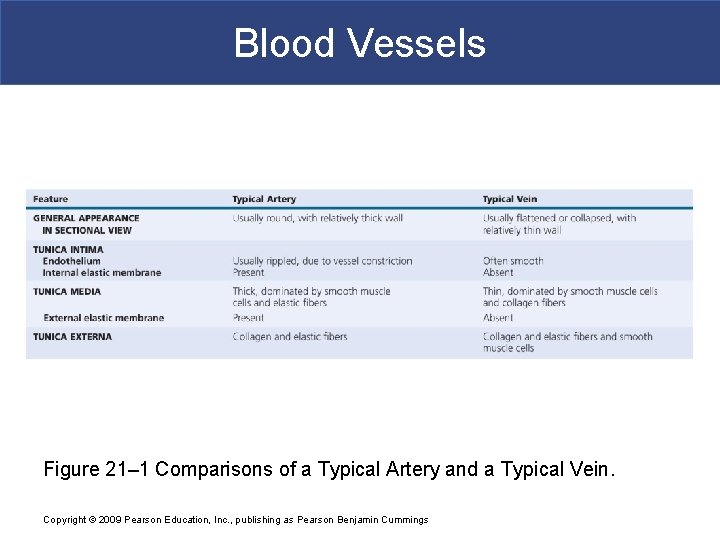 Blood Vessels Figure 21– 1 Comparisons of a Typical Artery and a Typical Vein.