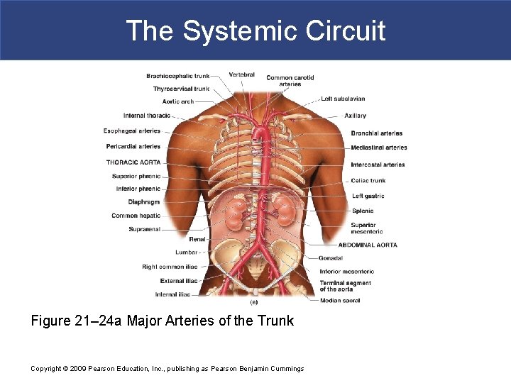 The Systemic Circuit Figure 21– 24 a Major Arteries of the Trunk Copyright ©