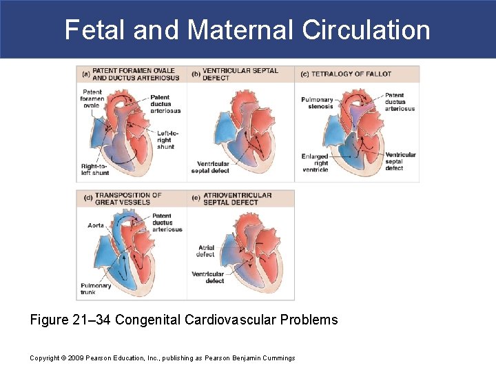 Fetal and Maternal Circulation Figure 21– 34 Congenital Cardiovascular Problems Copyright © 2009 Pearson