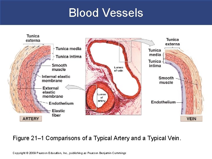 Blood Vessels Figure 21– 1 Comparisons of a Typical Artery and a Typical Vein.