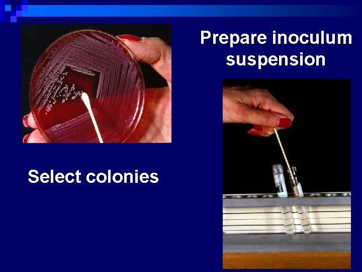 Prepare inoculum suspension Select colonies 